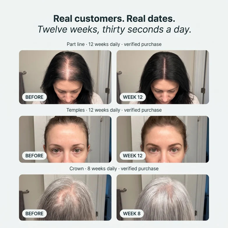 Fuller-Looking Roots in 12 Weeks, 30 Seconds a Day