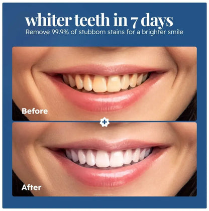Luvendi® Triple Action Teeth Whitening Powder